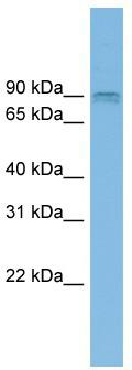 WB Suggested Anti-CENTG1 Antibody Titration: 0.2-1 ug/ml; ELISA Titer: 1: 312500; Positive Control: THP-1 cell lysate