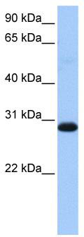 WB Suggested Anti-WARS2 Antibody Titration: 0.2-1 ug/ml; Positive Control: Human Muscle