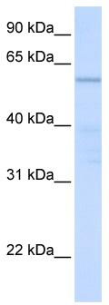 WB Suggested Anti-C16orf71 Antibody Titration: 0.2-1 ug/ml; ELISA Titer: 1: 312500; Positive Control: Human heart