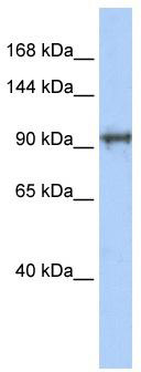 WB Suggested Anti-SPICE1 Antibody Titration: 0.2-1 ug/ml; ELISA Titer: 1: 312500; Positive Control: Transfected 293T