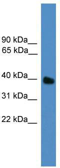 WB Suggested Anti-UBLCP1 Antibody Titration: 0.2-1 ug/ml; ELISA Titer: 1: 62500; Positive Control: HepG2 cell lysate