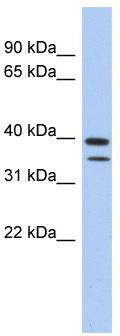 WB Suggested Anti-TRMT44 Antibody Titration: 0.2-1 ug/ml; ELISA Titer: 1: 312500; Positive Control: Human Spleen