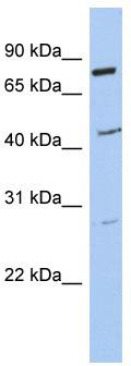 WB Suggested Anti-CCDC63 Antibody Titration: 0.2-1 ug/ml; ELISA Titer: 1: 1562500; Positive Control: SH-SYSY cell lysate