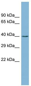 WB Suggested Anti-ZCCHC12 Antibody Titration: 0.2-1 ug/ml; ELISA Titer: 1: 312500; Positive Control: Human Stomach