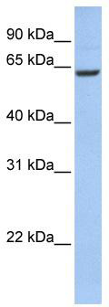WB Suggested Anti-CCDC67 Antibody Titration: 0.2-1 ug/ml; ELISA Titer: 1: 62500; Positive Control: 721_B cell lysate