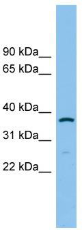 WB Suggested Anti-AKR1C2 Antibody Titration: 0.2-1 ug/ml; ELISA Titer: 1: 312500; Positive Control: MCF7 cell lysate
