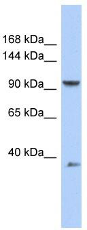 WB Suggested Anti-AP2B1 Antibody Titration: 0.2-1 ug/ml; ELISA Titer: 1: 1562500; Positive Control: OVCAR-3 cell lysate. AP2B1 is supported by BioGPS gene expression data to be expressed in OVCAR3