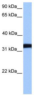 WB Suggested Anti-LDHC Antibody Titration: 0.2-1 ug/ml; Positive Control: NTERA2 cell lysate