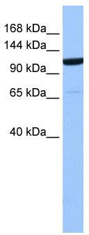 WB Suggested Anti-NUP155 Antibody Titration: 0.2-1 ug/ml; Positive Control: 721_B cell lysate