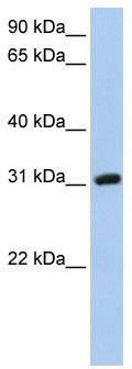 WB Suggested Anti-DKKL1 Antibody Titration: 0.2-1 ug/ml; Positive Control: HepG2 cell lysate