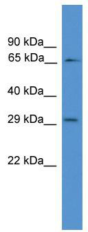 WB Suggested Anti-GK2 Antibody Titration: 0.2-1 ug/ml; ELISA Titer: 1: 1562500; Positive Control: Human Lung