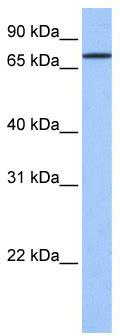 WB Suggested Anti-GK2 Antibody Titration: 0.2-1 ug/ml; Positive Control: Human brain