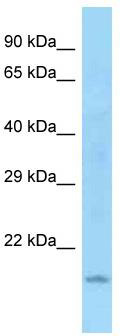 WB Suggested Anti-Wdr37 Antibody; Titration: 1.0 ug/ml; Positive Control: Mouse Heart