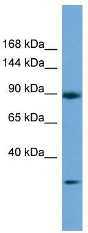 Host: Rabbit; Target Name: DENND5A; Sample Tissue: 721_B Whole cell lysates; Antibody Dilution: 1.0 ug/ml