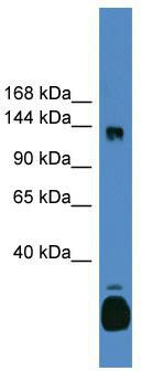 WB Suggested Anti-C10orf12 Antibody Titration: 0.2-1 ug/ml; ELISA Titer: 1: 1562500; Positive Control: Human kidney