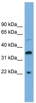 WB Suggested Anti-DOK6 Antibody Titration: 0.2-1 ug/ml; ELISA Titer: 1:1562500; Positive Control: COLO205 cell lysate