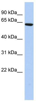 WB Suggested Anti-CCDC96 Antibody Titration: 0.2-1 ug/ml; ELISA Titer: 1:62500; Positive Control: HepG2 cell lysate