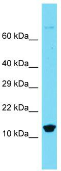 Host: Rabbit; Target Name: Mpc1; Sample Tissue: Rat Spleen lysates; Antibody Dilution: 1.0 ug/ml