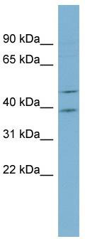 WB Suggested Anti-ACTL6B Antibody Titration: 0.2-1 ug/ml; ELISA Titer: 1:62500; Positive Control: Hela cell lysate