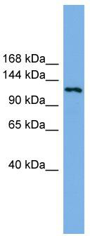 WB Suggested Anti-EIF4ENIF1 Antibody Titration: 0.2-1 ug/ml; ELISA Titer: 1:312500; Positive Control: U937 cell lysate