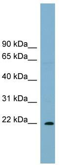 WB Suggested Anti-PCNP Antibody Titration: 0.2-1 ug/ml; Positive Control: Hela cell lysate