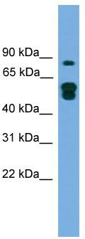 WB Suggested Anti-KIAA1609 Antibody Titration: 0.2-1 ug/ml; ELISA Titer: 1:1562500; Positive Control: Transfected 293T