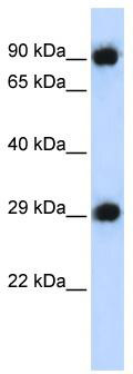 WB Suggested Anti-PSMA3 Antibody Titration: 0.2-1 ug/ml; ELISA Titer: 1:312500; Positive Control: 293T cell lysate
