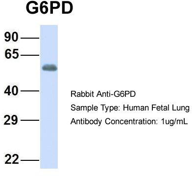 Host: Rabbit; Target Name: NSUN6; Sample Tissue: Human Fetal Lung; Antibody Dilution: 1.0 ug/ml