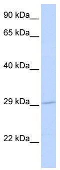 WB Suggested Anti-SLC25A6 Antibody Titration: 0.2-1 ug/ml; ELISA Titer: 1:1562500; Positive Control: Human heart