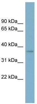 WB Suggested Anti-SPAG4L Antibody Titration: 0.2-1 ug/ml; ELISA Titer: 1:62500; Positive Control: ACHN cell lysate