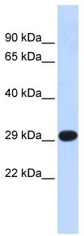 WB Suggested Anti-Tfam Antibody Titration: 0.2-1 ug/ml; ELISA Titer: 1:1562500; Positive Control: Mouse Muscle