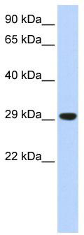 WB Suggested Anti-Tfam Antibody Titration: 0.2-1 ug/ml; ELISA Titer: 1:312500; Positive Control: Mouse Muscle