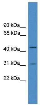 WB Suggested Anti-OTUD6A Antibody Titration: 0.2-1 ug/ml; ELISA Titer: 1:312500; Positive Control: Jurkat cell lysate