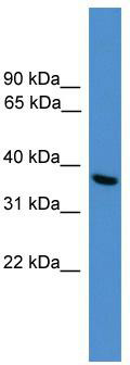 WB Suggested Anti-UCHL5 Antibody Titration: 0.2-1 ug/ml; ELISA Titer: 1:312500; Positive Control: HepG2 cell lysate