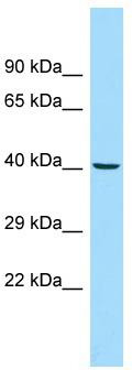 Host: Rabbit; Target Name: ADRM1; Sample Tissue: MCF7 Whole Cell lysates; Antibody Dilution: 1.0 ug/ml ADRM1 is supported by BioGPS gene expression data to be expressed in MCF7