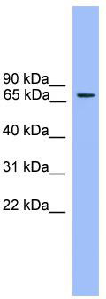 WB Suggested Anti-Rph3a Antibody Titration: 0.2-1 ug/ml; ELISA Titer: 1:1562500; Positive Control: Mouse Muscle