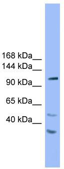 WB Suggested Anti-STARD8 Antibody; Titration: 1.0 ug/ml; Positive Control: 293T Whole Cell
