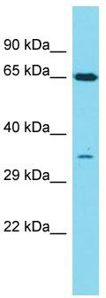 Host: Rabbit; Target Name: Olr1087; Sample Tissue: Rat Spleen lysates; Antibody Dilution: 1.0 ug/ml