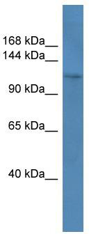 WB Suggested Anti-COL1A1 Antibody Titration: 0.2-1 ug/ml; ELISA Titer: 1:62500; Positive Control: Human brain