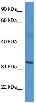 WB Suggested Anti-CA5A Antibody Titration: 0.2-1 ug/ml; ELISA Titer: 1:312500; Positive Control: A549 cell lysate