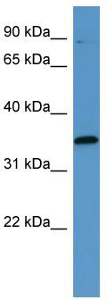 WB Suggested Anti-MAPKAPK3 Antibody Titration: 0.2-1 ug/ml; ELISA Titer: 1:62500; Positive Control: Human kidney