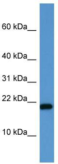 WB Suggested Anti-SH2D1A Antibody Titration: 0.2-1 ug/ml; ELISA Titer: 1:312500; Positive Control: Jurkat cell lysate SH2D1A is strongly supported by BioGPS gene expression data to be expressed in Human Jurkat cells