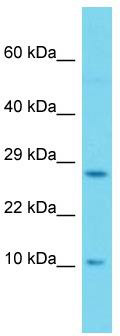 Host: Rabbit; Target Name: SH2D1A; Sample Tissue: 293T Whole Cell lysates; Antibody Dilution: 1.0 ug/ml