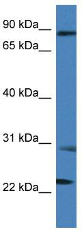 WB Suggested Anti-MIA2 Antibody; Titration: 1.0 ug/ml; Positive Control: THP-1 Whole Cell