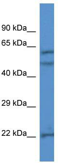 WB Suggested Anti-HPSE Antibody; Titration: 1.0 ug/ml; Positive Control: Jurkat Whole Cell