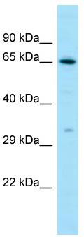 Host: Rabbit; Target Name: LHCGR; Sample Tissue: THP-1 whole cell lysates; Antibody Dilution: 1.0 ug/ml