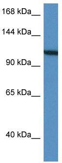 WB Suggested Anti-VCL Antibody; Titration: 1.0 ug/ml; Positive Control: HepG2 Whole Cell