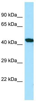 Host: Rabbit; Target Name: TNFAIP3; Sample Tissue: ACHN whole cell lysates; Antibody Dilution: 1.0 ug/ml