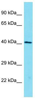 Host: Rabbit; Target Name: Eif4b; Sample Tissue: Mouse Brain lysates; Antibody Dilution: 1.0 ug/ml