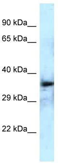 Host: Rabbit; Target Name: DEPTOR; Sample Tissue: Fetal Brain lysates; Antibody Dilution: 1.0 ug/ml